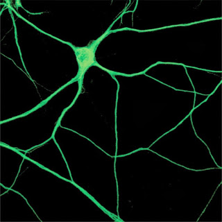 Microtubules the &#8220;tape archive&#8221; of the brain?